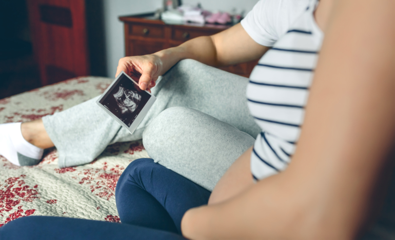 Explore the purpose and benefits of an elective pregnancy scan in this parent-friendly guide—what to expect, timing, safety, and keepsake options.